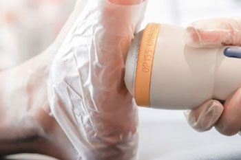 softwave shockwave therapy